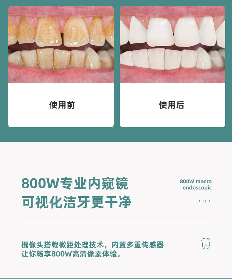 新款高清可视洁牙仪,去牙垢牙结石,牙齿美牙神器,洗牙器,智能美牙仪